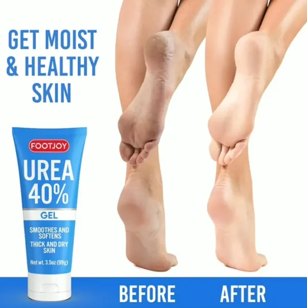 Urea Foot Gel 40% for Cracked Feet, Elbows