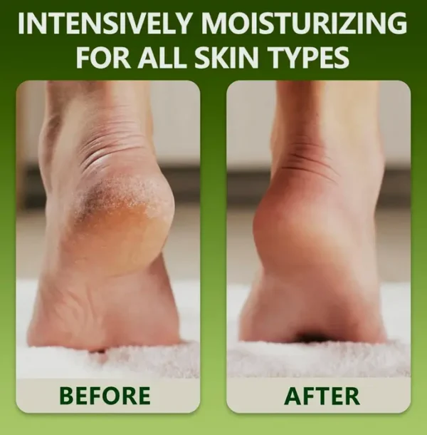 Natural Foot Cream - Repair Dry Feet - 6.35 oz.