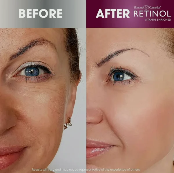 Anti-Aging Starter Set – Original Skincare Line for a Youthful Appearance