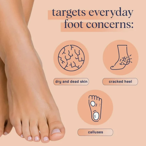SpaLife Exfoliating Foot Masks (Pack of 8)
