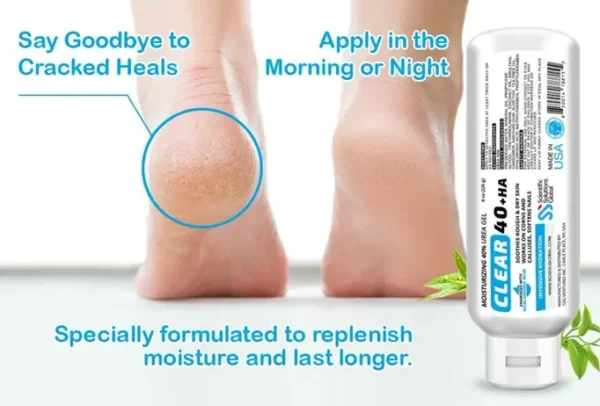 40 Percent Urea-infused Gel with Hyaluronic Acid & T-Tree Oil