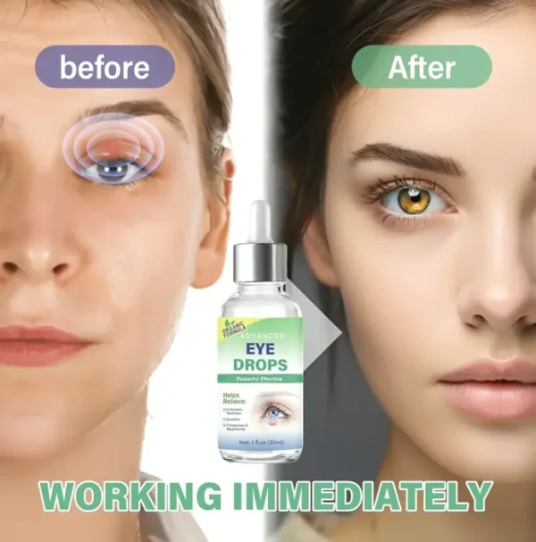 Stye Ocular Care, Serum for Styes , Chalazion, 30ml