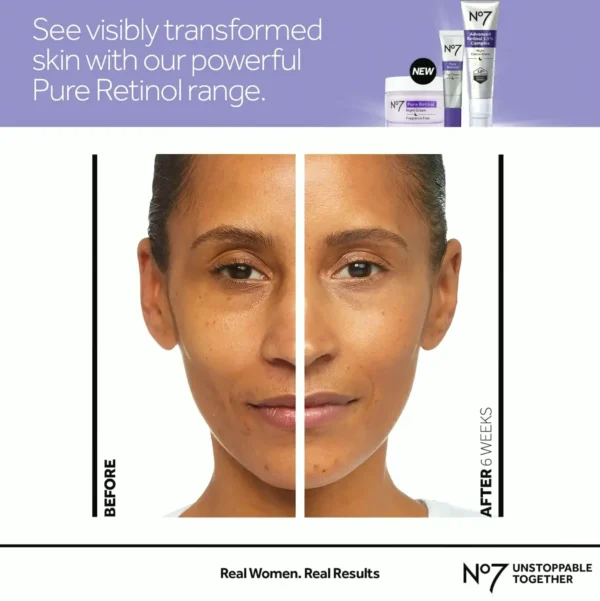 #7 Retinol Eye Cream with Peptides and Shea Butter for Fine Lines (0.5 oz)