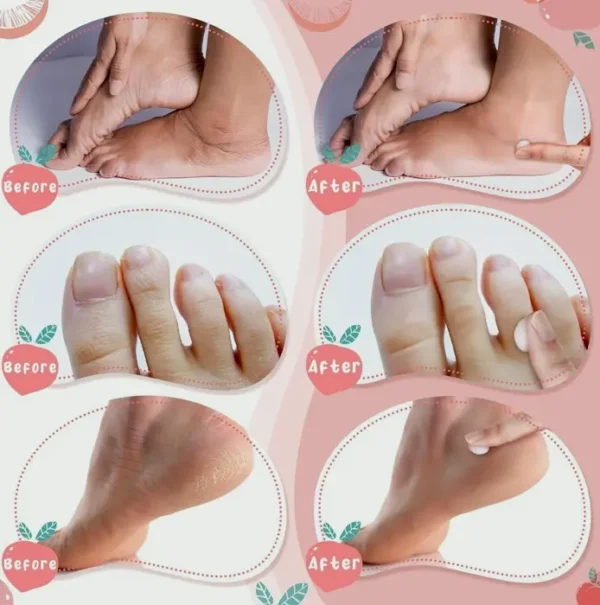 Sixty Pieces Foot Repair Moisturizer Set