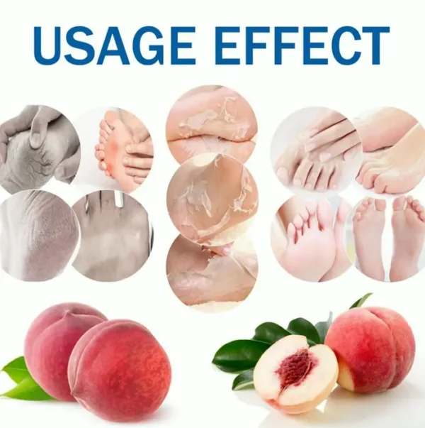 Foot Peel Mask for Dry Heels (3 Sets)